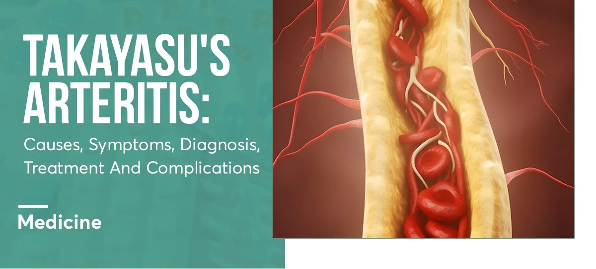 Takayasu's Arteritis Treatment at IRIS