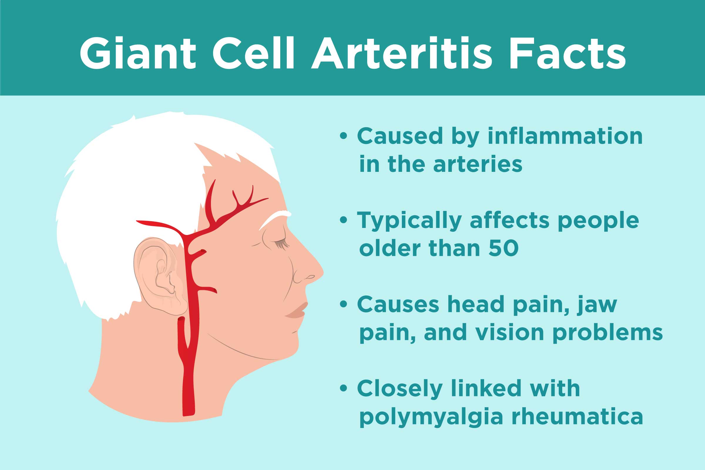 Giant Cell Arteritis Treatment at IRIS