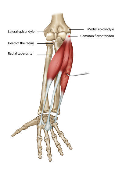 Medial Epicondylitis Symptoms