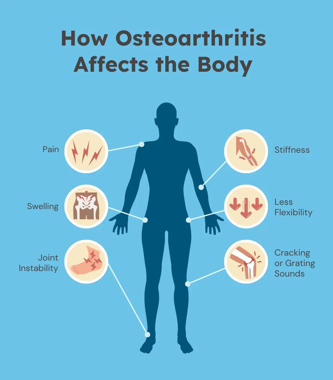 Osteoarthritis Symptoms