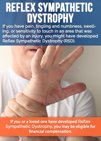 Reflex Sympathetic Dystrophy Symptoms
