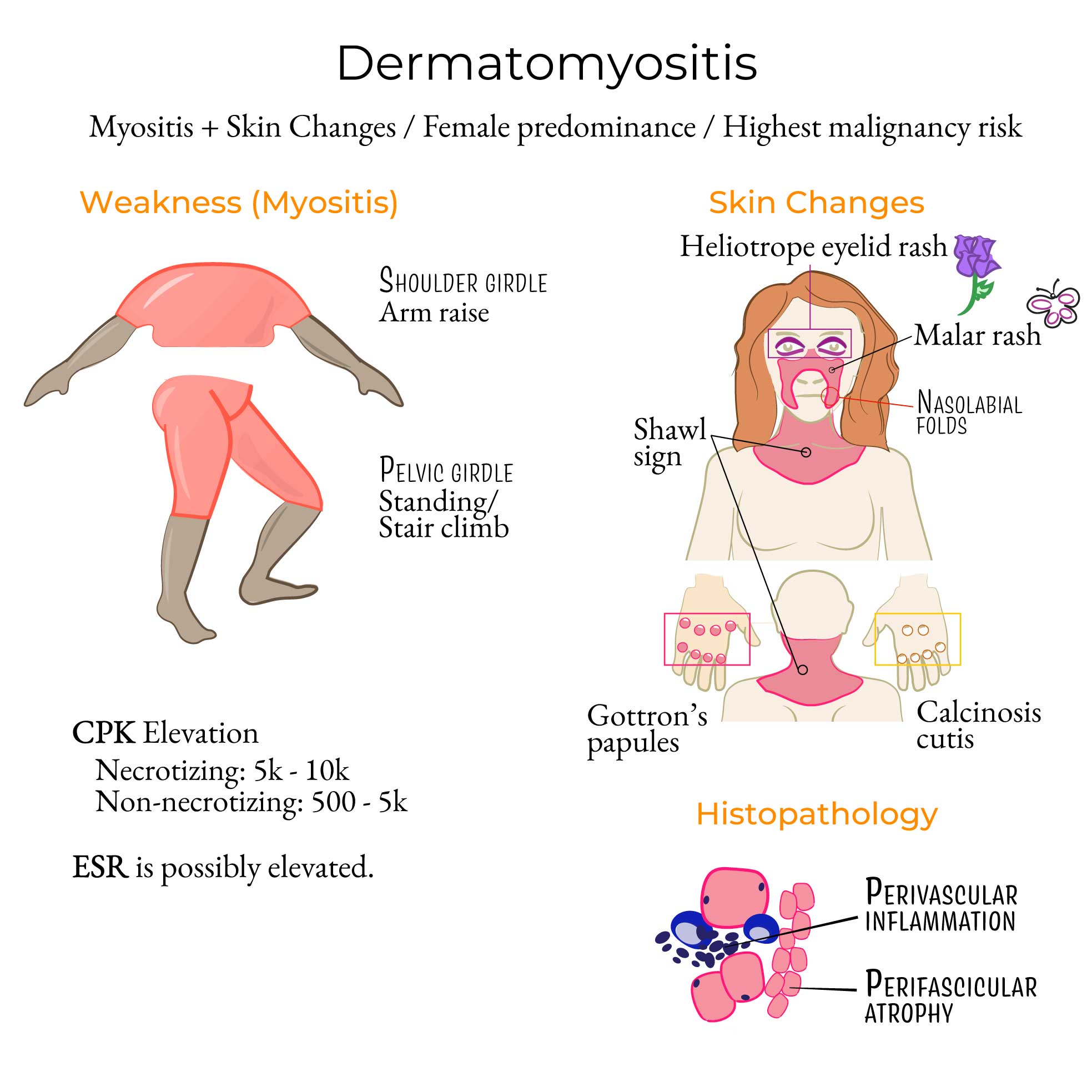 Dermatomyositis Symptoms